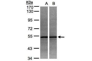 WB Image Sample(30 ug whole cell lysate) A:HeLa S3, B:MOLT4 , 7.