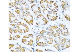 Immunohistochemistry of paraffin-embedded Human stomach using NDUFA5 Polyclonal Antibody at dilution of 1:100 (40x lens). (NDUFA5 Antikörper)