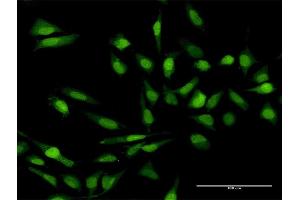 Immunofluorescence of purified MaxPab antibody to IL17C on HeLa cell. (IL17C Antikörper  (AA 1-197))