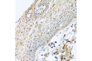 Immunohistochemistry of paraffin-embedded human esophagus using NDUFA2 antibody. (NDUFA2 Antikörper)