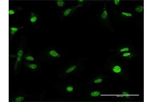 Immunofluorescence of purified MaxPab antibody to RFX5 on HeLa cell. (RFX5 Antikörper  (AA 1-616))