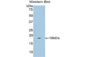 Western blot analysis of the recombinant protein. (Myoglobin Antikörper  (AA 1-154))