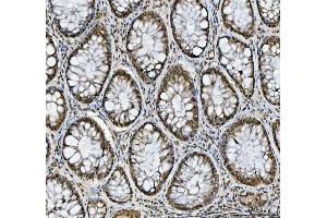 IHC analysis of hnRNP L/HNRNPL using anti-hnRNP L/HNRNPL antibody (ABIN7600130). (HNRNPL Antikörper  (AA 152-569))