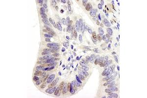 Immunohistochemistry (IHC) image for anti-Ubiquitin Specific Peptidase 28 (USP28) (AA 50-100) antibody (ABIN7448853) (USP28 Antikörper  (AA 50-100))