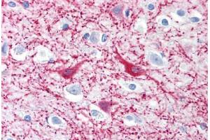 Human Brain, Cortex (formalin-fixed, paraffin-embedded) stained with MAP2 antibody ABIN239819 at 10 ug/ml followed by biotinylated anti-mouse IgG secondary antibody ABIN481714, alkaline phosphatase-streptavidin and chromogen. (MAP2 Antikörper)