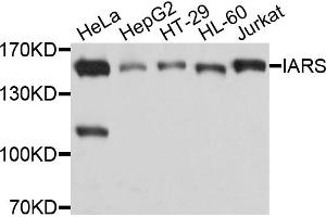 Western blot analysis of extracts of various cell lines, using IARS antibody. (IARS Antikörper)