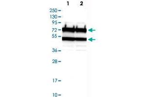Western Blot analysis of Lane 1: RT-4 and Lane 2: U-251 MG sp cell lysates with CDC16 polyclonal antibody . (CDC16 Antikörper)