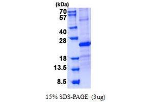 Image no. 1 for Sclerostin Domain Containing 1 (SOSTDC1) protein (His tag) (ABIN1098746)