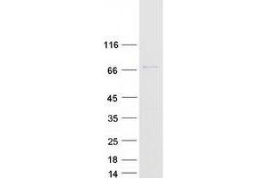 TIGD6 Protein (Myc-DYKDDDDK Tag)