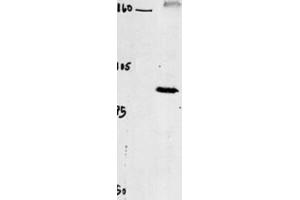Western Blotting (WB) image for anti-Chloride Channel 4 (CLCN4) antibody (ABIN3002620) (CLCN4 Antikörper)