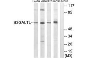 Western blot analysis of extracts from HuvEc/MCF-7/Jurkat/HepG2 cells, using B3GALTL Antibody. (B3GALTL Antikörper  (AA 449-498))