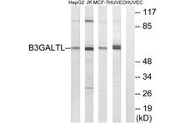 B3GALTL antibody  (AA 449-498)