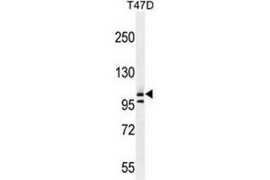 COL1A2 Antibody (N-term) western blot analysis in T47D cell line lysates (35µg/lane). (COL1A2 Antikörper  (Chain alpha 2, N-Term))