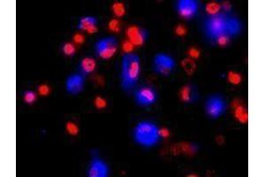 Immunofluorescence (IF) image for anti-Lysosomal-Associated Membrane Protein 2 (LAMP2) antibody (Alexa Fluor 647) (ABIN2657608) (LAMP2 Antikörper  (Alexa Fluor 647))