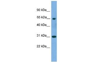 WB Suggested Anti-PNKP Antibody Titration: 0. (PNKP Antikörper  (Middle Region))