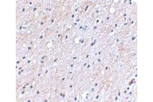 Immunohistochemical staining of human brain tissue using NIPSNAP1 polyclonal antibody  at 2. (NIPSNAP1 Antikörper  (C-Term))