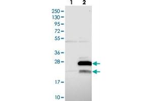 Western blot analysis of Lane 1: Negative control (vector only transfected HEK293T lysate), Lane 2: Over-expression Lysate (Co-expressed with a C-terminal myc-DDK tag (~3. (MRPL47 Antikörper)