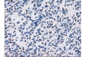 Image no. 10 for anti-Budding Uninhibited By Benzimidazoles 1 Homolog beta (Yeast) (BUB1B) antibody (ABIN1496996) (BUB1B Antikörper)