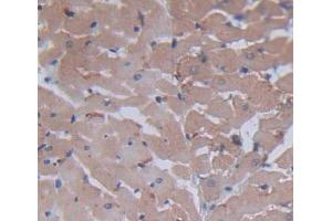 Used in DAB staining on fromalin fixed paraffin- embedded heart tissue (BNIP3 Antikörper  (AA 3-134))