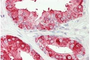 Human Prostate: Formalin-Fixed, Paraffin-Embedded (FFPE) (Tachykinin 3 Antikörper  (AA 54-83))