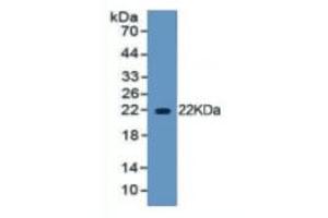 WB of Protein Standard: different control antibodies against Highly purified E. (HMGB1 ELISA Kit)
