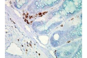 Image no. 2 for anti-Heat Shock Protein 70 (HSP70) (AA 436-503) antibody (ABIN466875) (HSP70 Antikörper  (AA 436-503))