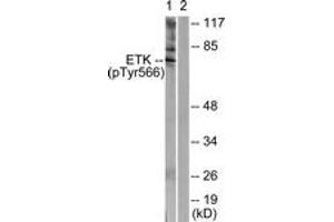 Western blot analysis of extracts from HeLa cells treated with Serum 20% 15', using ETK (Phospho-Tyr566) Antibody. (BMX Antikörper  (pTyr566))