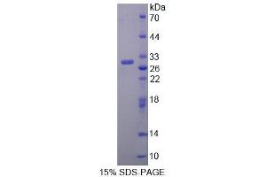 SDS-PAGE (SDS) image for Branched Chain Amino-Acid Transaminase 1, Cytosolic (BCAT1) (AA 179-411) protein (His tag) (ABIN6239353)