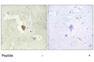 Immunohistochemistry analysis of paraffin-embedded human brain tissue using ADCY7 polyclonal antibody . (ADCY7 Antikörper)