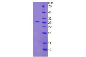 Image no. 1 for Interferon Induced with Helicase C Domain 1 (IFIH1) (AA 605-815) protein (His tag) (ABIN4990937)
