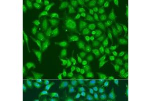 Immunofluorescence analysis of U2OS cells using CENPQ Polyclonal Antibody at dilution of 1:100. (CENPQ Antikörper)