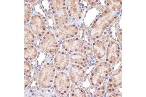 Immunohistochemistry of paraffin-embedded rat kidney using Transportin 3 (Transportin 3 (TNPO3)) Rabbit mAb (ABIN7270971) at dilution of 1:100 (40x lens). (Transportin 3 Antikörper)