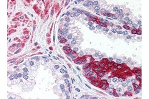 Image no. 1 for anti-ADAM Metallopeptidase Domain 12 (ADAM12) (N-Term) antibody (ABIN372949) (ADAM12 Antikörper  (N-Term))