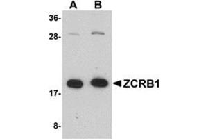 Western blot analysis of ZCRB1 in Raji cell lysate with this product at (A) 1 and (B) 2 μg/ml. (ZCRB1 Antikörper  (C-Term))