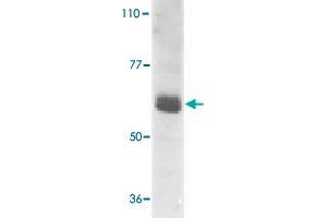 Western blot analysis of IL22RA1 expression in human HepG2 cell lysate with IL22RA1 polyclonal antibody  at 1 ug /mL . (IL22 Receptor alpha 1 Antikörper  (AA 560-574))