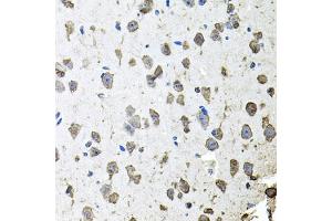 Immunohistochemistry of paraffin-embedded mouse brain using FGF1 antibody. (FGF1 Antikörper)