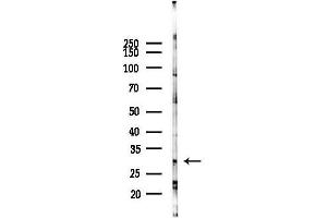 anti-Uncoupling Protein 3 (Mitochondrial, Proton Carrier) (UCP3) (C-Term) antibody