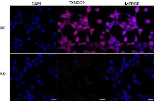 Immunocytochemical staining of HeLa cells using TXNDC9 antibody (ABIN7800543), 1:1,000), Top panel: wild-type (WT), Bottom panal: TXNDC9 shRNA knockdown (KD).