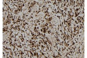 ABIN6278767 at 1/100 staining Human gastric tissue by IHC-P. (LMO7 Antikörper  (C-Term))