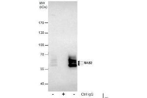 IP Image Immunoprecipitation of NAB2 protein from Jurkat whole cell extracts using 5 μg of NAB2 antibody, Western blot analysis was performed using NAB2 antibody, EasyBlot anti-Rabbit IgG  was used as a secondary reagent. (NAB2 Antikörper)