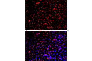 Immunofluorescence analysis of U20S cell using ENOX2 antibody. (ENOX2 Antikörper)