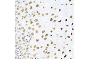 Immunohistochemistry of paraffin-embedded human esophagus using SSB antibody at dilution of 1:100 (40x lens). (SSB Antikörper)