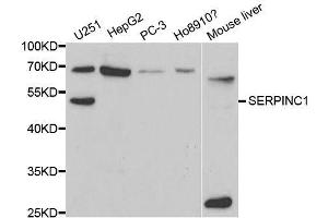 Western blot analysis of extracts of various cell lines, using SERPINC1 antibody. (SERPINC1 Antikörper  (AA 33-185))