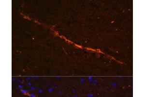 Immunofluorescence analysis of Rat brain using CD34 Polyclonal Antibody at dilution of 1:100. (CD34 Antikörper)