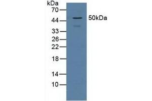 Detection of PSMD5 in Human Jurkat Cells using Polyclonal Antibody to Proteasome 26S Subunit, Non ATPase 5 (PSMD5) (Proteasome 26S Subunit, Non ATPase 5 (AA 143-341) Antikörper)