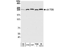 Western Blotting (WB) image for anti-Cytoskeleton Associated Protein 5 (CKAP5) (AA 1425-1475) antibody (ABIN7450110) (CKAP5 Antikörper  (AA 1425-1475))