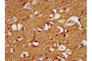 IHC image of ABIN7157473 diluted at 1:500 and staining in paraffin-embedded human brain tissue performed on a Leica BondTM system. (CRYM Antikörper  (AA 169-258))