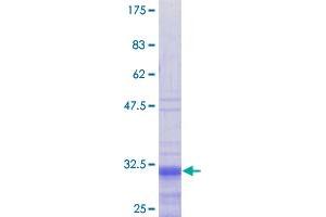 Image no. 1 for Protamine 1 (PRM1) (AA 1-51) protein (GST tag) (ABIN1316323)