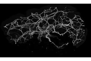 Immunofluorescence analysis of entire human skin, optically cleared with BABB, using CD31 (2MAC4, 2PEC47, 3MAC24, 3MAC69, 3MAC82, 3PEC82, 20 μg/mL) polyclonal LIMAAbody®, labelled with Alexa Fluor® 647 imaged on Zeiss LS7. (Rekombinanter CD31 Antikörper  (Extracellular Domain))