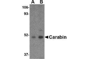 Image no. 1 for anti-TBC1 Domain Family, Member 10C (TBC1D10C) (C-Term) antibody (ABIN490812)